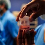 ¡Alerta! En aumento casos de «hongo negro» en Honduras ¡Alerta! En aumento casos de "hongo negro" en Honduras