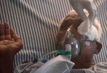 Bolivia confirma el primer caso de hongo negro en paciente con covid-19 Bolivia confirma el primer caso de hongo negro en paciente con covid-19