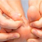 Padeces de hongos en los pies ¿Cómo tratarlo? Hongos en los Pies