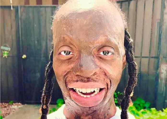 Casi muere en un incendio y ahora es la nueva estrella de TikTok