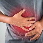 Los casos de cáncer colorrectal están aumentando en jóvenes enfermedad, cáncer, Causas, riesgo, colorrectal,