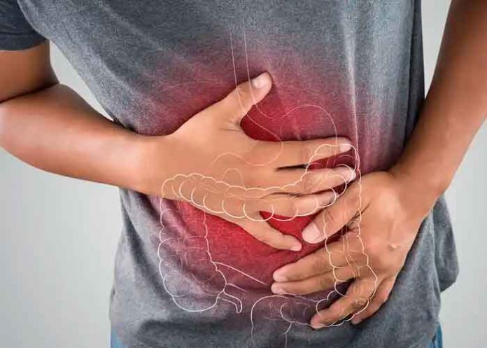 enfermedad, cáncer, Causas, riesgo, colorrectal,