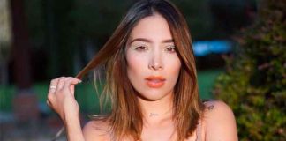 foto, instagram, luisa fermanda w, alopecia, salud, influencer,