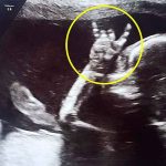 Ultrasonido de un bebé rockeando