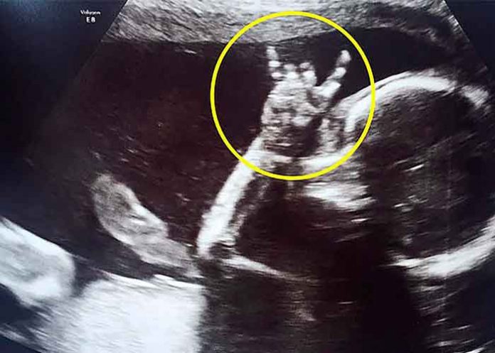 nueva-zelanda- Ultrasonido de un bebé rockeando