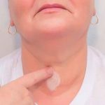 salud, tiroxina, hormona, causas,