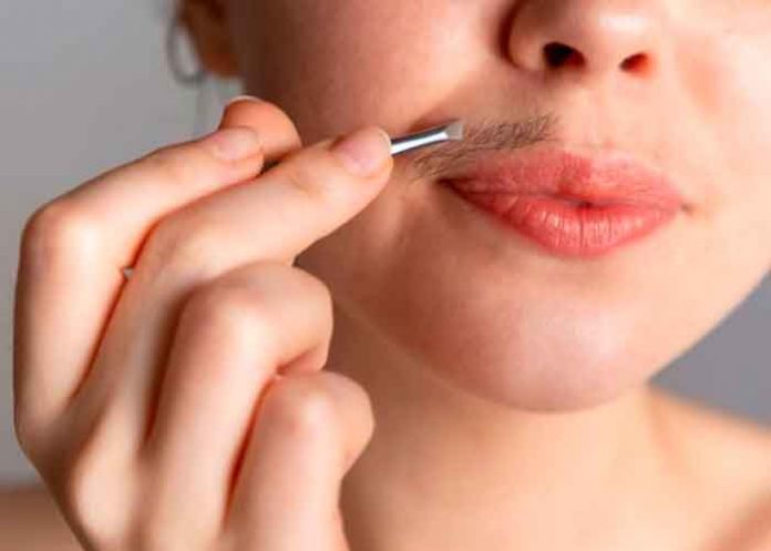 florida, video, tiktok, vello, viral, rostro, ovario poliquistico, hirsutismo,