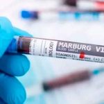 ¡Tan mortífera como el ébola! Primer caso virus de Marburgo en África