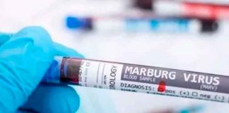 ¡Tan mortífera como el ébola! Primer caso virus de Marburgo en África