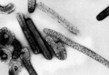 Guinea detecta posible caso de fiebre de Marburgo, similar al ébola