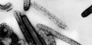 Guinea detecta posible caso de fiebre de Marburgo, similar al ébola