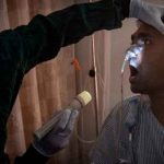 Aumentan casos de «Hongo Negro» en Honduras, confirman nueve más Aumentan casos de "Hongo Negro" en Hondura, confirman nueve más