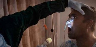 Aumentan casos de "Hongo Negro" en Hondura, confirman nueve más