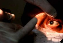 Paciente de "Hongo Negro" en tratamiento médico
