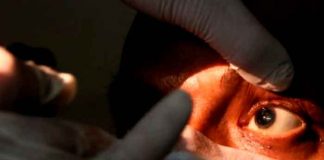 Paciente de "Hongo Negro" en tratamiento médico
