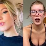 Tiktoker tuvo la variante Delta y sus labios se pusieron negros Tiktoker tuvo la variante Delta y sus labios se pusieron negros