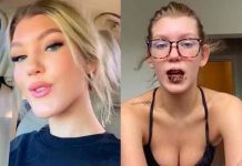 Tiktoker tuvo la variante Delta y sus labios se pusieron negros