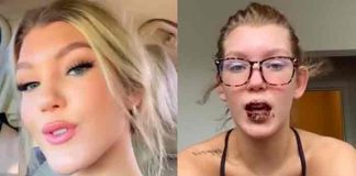 Tiktoker tuvo la variante Delta y sus labios se pusieron negros