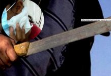 Niña recibe un machetazo tras oponerse a ser violada en Honduras.