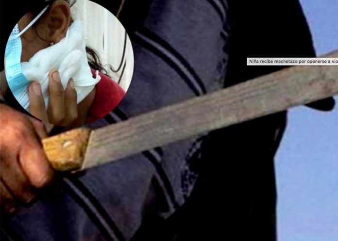 Niña recibe un machetazo tras oponerse a ser violada en Honduras.