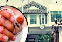 Liberan a padre que le quemó las manos a su hija en Honduras Liberan a padre que le quemó las manos a su hija en Honduras