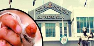Liberan a padre que le quemó las manos a su hija en Honduras