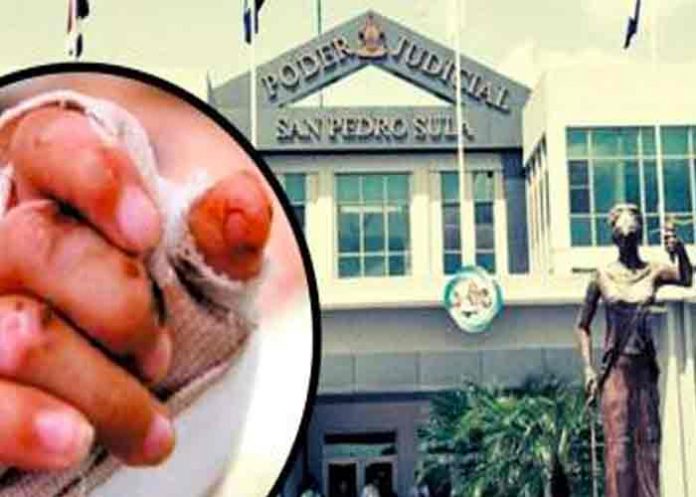 Liberan a padre que le quemó las manos a su hija en Honduras