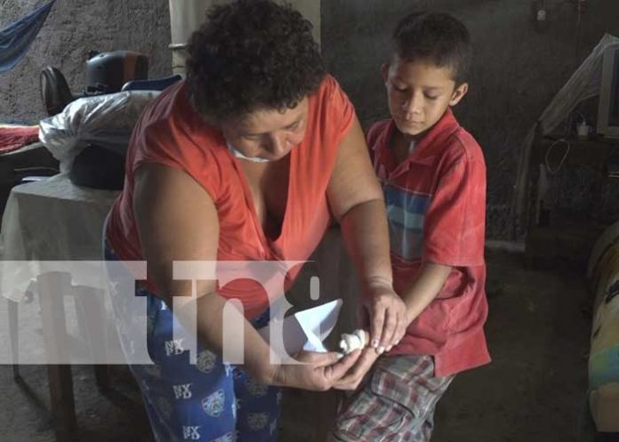 Madre preocupada por gastos tras ataque de perro Pitbull a su hijo