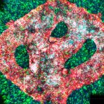 Tumor bio impreso en 3D