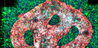 Tumor bio impreso en 3D