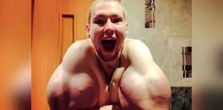 ¡De impacto! Popeye ruso se le ‘explotan’ los brazos (FOTOS)