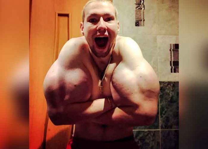 ¡De impacto! Popeye ruso se le ‘explotan’ los brazos (FOTOS)