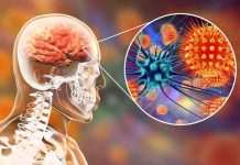 La Organización Mundial de la Salud quiere acabar con la meningitis para 2030 La Organización Mundial de la Salud quiere acabar con la meningitis para 2030