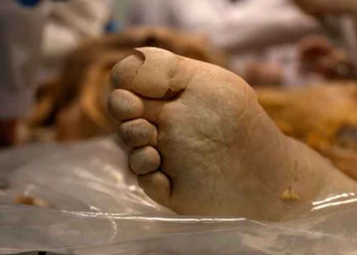 Vive con el cadáver de la abuela por cobrar pensión