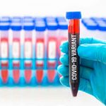 «Mu» la nueva variante de Covid-19 podría ser más peligrosa que Delta Prueba de Sangre con la nueva variante covi-19