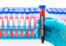 «Mu» la nueva variante de Covid-19 podría ser más peligrosa que Delta Prueba de Sangre con la nueva variante covi-19