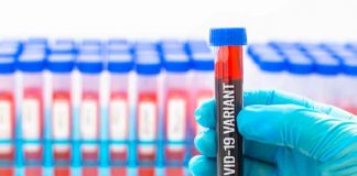 Prueba de Sangre con la nueva variante covi-19