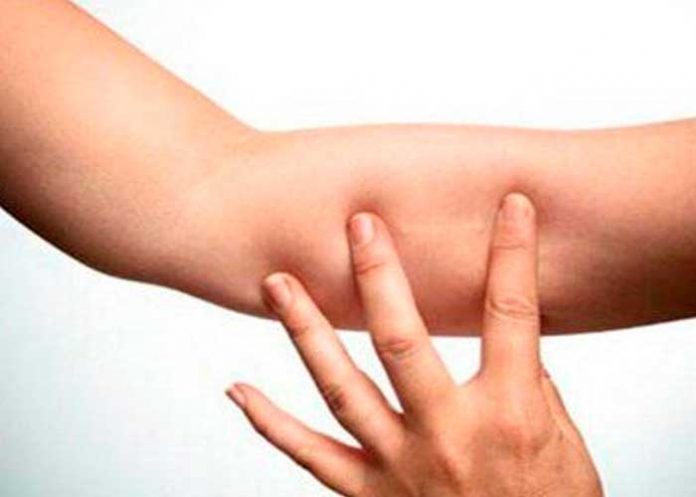 diu Esto ocurre si olvidas quitarte el DIU en el tiempo indicado