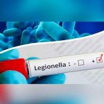 Brote de legionela al sur de España dejó ocho afectados Brote de legionela al sur de España dejó ocho afectados