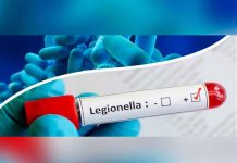 Brote de legionela al sur de España dejó ocho afectados