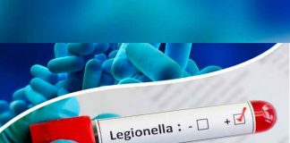 Brote de legionela al sur de España dejó ocho afectados