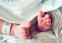 Confirman la muerte de un bebé por afectación de “Hongo Negro» en Honduras Confirman la muerte de un bebé por afectación de “Hongo Negro" en Honduras