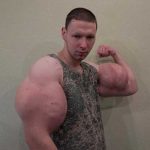 Los brazos del Popeye ruso explotan en un combate.