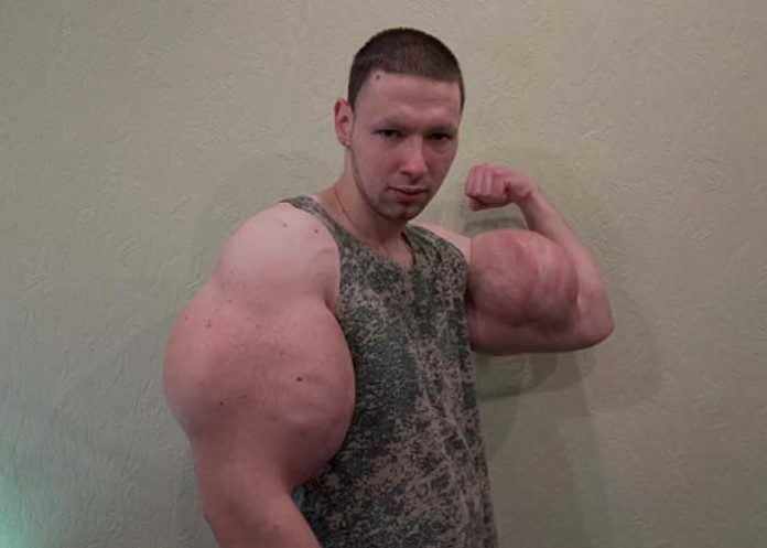 Los brazos del Popeye ruso explotan en un combate.