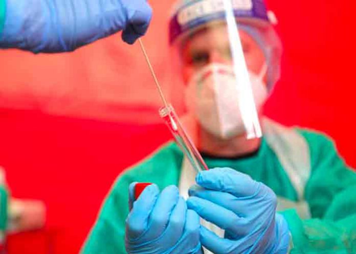 variante-mu- Variante “Mu” del COVID-19 ya se encuentra en 49 estados de EE.UU.