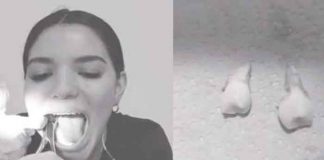VIDEO: Mujer se saca las muelas de juicio sin ayuda y se hace viral