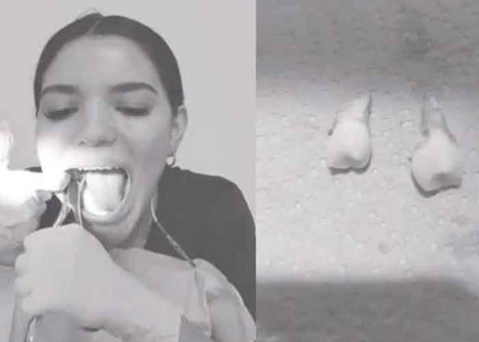 VIDEO: Mujer se saca las muelas de juicio sin ayuda y se hace viral