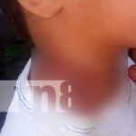 nicaragua, waslala, rayo,