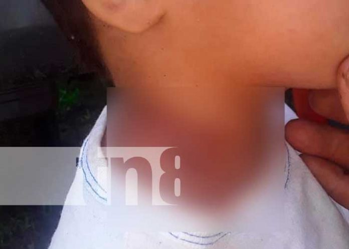 w2 nicaragua, waslala, rayo,