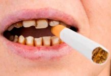¿Cómo afecta el cigarro a la salud de los dientes? ventajas y desventajas ¿Cómo afecta el cigarro a la salud de los dientes?